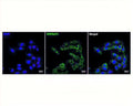 Immunofluorescent staining of internalized NGFR/p75 receptor (green) in rat C6 glioma cells. Live cells were incubated with FITC-labelled NGFR/p75 antibody clone (2 µg/mL) for 1 hour at 37C, fixed (4% formaldehyde), and cell nuclei stained with DAPI (blue). Confocal images (60x magnification) demonstrate typical vesicle-like, punctuate perinuclear staining of internalized receptor/antibody.
