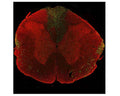 Image of a rat spinal cord coronal section with a three-day-old midline C4 contusion injury by Immunofluorescence and Immunohistochemistry. The section was stained with M-2122-50, Neurofilament light polypeptide (NF-L), DG-Sensor™, Clone 6H63, Mouse mAb, (green), and co-stained with product R-2113-50, Neurofilament light polypeptide, C-terminus, (NF-L-Ct), Rabbit pAb, (red). Product M-2122-50 stains prominent material aggregates in the lateral funiculi and dorsal columns, where the material is concentrated but less so elsewhere in the section. Due to the C4 lesion, these axons are deteriorating and dying. As product R-2113-50 binds to the C-terminal "tail" region of NF-L, which is absent or destroyed during degeneration, only M-2122-50 staining is observed in the degenerating neurons; positive staining for R-2113-50 in those regions is largely negative.