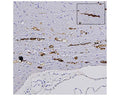 Image of formalin-fixed paraffin-embedded sections of a mouse model of ALS (Acta Neuropathol. 2016 Jan; 131(1): 103-114) by Immunohistochemistry. The section was stained with M-2123-100, Neurofilament light polypeptide (NF-L), DG-Sensor™, Clone 1D44, Mouse mAb. These heterozygous G85R-SOD1-YFP mice do not develop ALS unless primed with mutant SOD1 aggregates, indicating that this is a model of prion induction of pathogenesis. Degenerated processes were seen in the sciatic nerve, spinal cord fibers, and, as shown here, the brain stem after this mouse was injected with mutant SOD1. The inset depicts a helical typical of degenerating processes.