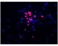 Image of fixed and permeabilized rat hippocampal cells by Immunofluorescence and Immunocytochemistry. Staining of NeuN (NeuN-IR, red) is localized to cell nuclei (blue) and appears pink due to overlaying colors.NeuN-IR is absent from other cell nuclei, demonstrating the presence of non-neuronal cells in this mixed culture. Primary antibody concentration: 2 µg/mL; Magnification: 32X. Image courtesy of QBM Cell Science.