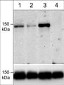 Western blot analysis of COS-7 cells expressing flag-tagged mDia2 (lanes 1-3) or mDia2 mutant (T1061A) (lane 4). The cells were untreated (lane 1) or treated with calyculin A (lanes 2 & 3). The blot was treated with alkaline phosphatase (lane 2), then probed with anti-mDia2 (Thr-1061) (upper blot) or anti-flag antibody (lower blot). (Image provided by Dr. Christopher Mack in the Dept. of Pathology at UNC Chapel Hill).