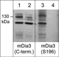 Western blot analysis of mDia3 expression in human Jurkat cells treated with Calyculin A (100 nM) (lanes 1-4). The blots were treated with lambda phosphatase (lanes 2 & 4), then probed with rabbit polyclonal anti-mDia3 (C-terminus; DP4511) (lanes 1 & 2) and anti-phospho-mDia3 (Ser-196; DP4521) (lanes 3 & 4).
