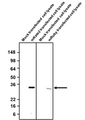 Western blotting of mock, mKate2, or mRuby transfected COS-7 cell lysates with Aves Labs chicken anti-mKate2 antibody (0.2 ug/ml) and detected with anti-chicken HRP secondary antibody (Cat. 80-1000-HRP). Aves Labs chicken anti-mKate2 recognizes exogenous mKate2 as well as mRuby, another fluorescent protein derived from Entacmaea quadricolor in COS-7