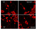 Immunocytochemical labeling of nNOS phosphorylation in rat PC12 cells differentiated with NGF. The cells were probed with mouse monoclonal (mAb) nNOS (NM4011), and rabbit polyclonal (pAb) nNOS (C-terminal region), nNOS (Tyr-895)/eNOS (Tyr-657), and nNOS (Tyr-1326)/iNOS (Tyr-1055). The antibodies were detected using appropriate secondary antibody conjugated to DyLight® 594.