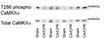 Western immunoblot measuring levels of T286 phosphorylation of CaMKII (Cat. p1005-286,1:1000) normalized to total CaMKII in the membrane fraction of whole hippocampi from sham and CA/CPR operated mice. Image for publication, CC-BY-4.0. PMID: 38565288.
