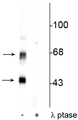 Western blot of rat brain lysate showing specific immunolabeling of the ~50 kDa α- and the ~60 kDa β-CaM Kinase II phosphorylated at Thr306 in the first lane (-). Phosphospecificity is shown in the second lane (+) where the immunolabeling is completely eliminated by lysate treatment with lambda phosphatase (λ-Ptase, 800 units/1mg protein for 30 minutes).