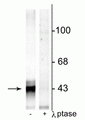 Western blot of rat hippocampal lysate showing specific immunolabeling of the ~43 kDa connexin43 phosphorylated at Ser368 in the first lane (-). Phosphospecificity is shown in the second lane (+) where immunolabeling is completely eliminated by lysate treatment with lambda phosphatase (λ-Ptase, 800 units/1mg protein for 30 min).