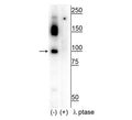 Western blot of human T47D cell lysate showing specific immunolabeling of the ~100 kDa CtIP phosphorylated at Ser326 in the first lane (-). Phosphospecificity is shown in the second lane (+) where immunolabeling is completely eliminated by blot treatment with lambda phosphatase (λ-Ptase, 1200 units for 30 min).