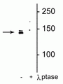 Western blot of HeLa cell lysate showing specific immunolabeling of the ~142 kDa DENND3 protein phosphorylated at Ser554 in the first lane (-). Phosphospecificity is shown in the second lane (+) where immunolabeling is completely eliminated by lysate treatment with lambda phosphatase (λ-Ptase, 800 units/1mg protein for 30 min).