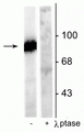 Western blot of rat hippocampal lysate stimulated with forskolin showing specific immunolabeling of the ~95 kDa dynamin phosphorylated at Ser778 in the first lane (-). Phosphospecificity is shown in the second lane (+) where immunolabeling is completely eliminated by blot treatment with lambda phosphatase (λ-Ptase, 1200 units for 30 min).