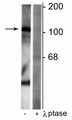 Western blot of rat synaptic membrane lysate showing specific immunolabeling of the ~102 kDa GABAB R1 protein phosphorylated at Ser923 in the first lane (-). Phosphospecificity is shown in the second lane (+) where immunolabeling is completely eliminated by blot treatment with lambda phosphatase (λ-Ptase, 1200 units for 30 min).