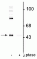 Western blot of rat cortical lysate showing specific immunolabeling of the ~50 kDa Gap-43 protein phosphorylated at Ser41 in the first lane (-). Phosphospecificity is shown in the second lane (+) where immunolabeling is completely eliminated by blot treatment with lambda phosphatase (λ-Ptase, 1200 units for 30 min).