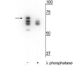 Western blot of T47D cell lysate treated with EGF (1 nM) for 60 minutes showing specific labeling of the ~70 kDa Hsp70 in the first lane (-). Phosphospecificity is shown in the second lane (+) where immunolabeling is eliminated or significantly decreased with lambda phosphatase (λ-Ptase, 1200 units for 30 minutes).