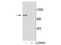 Western blot of rat brain lysate showing specific immunolabeling of the ~87 kDa MARCKS protein phosphorylated at Ser152,156, in the first lane (-). Phosphospecificity is shown in the second lane (+) where immunolabeling is completely eliminated by blot treatment with lambda phosphatase (λ-Ptase, 1200 units for 30 min).