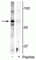 Western blot of mouse whole brain lysate showing specific immunolabeling of the ~55 kDa truncated MeCP2 protein phosphorylated at Ser421 in the first lane (-). Phosphospecificity is shown in the second lane (+) where immunolabeling is blocked by preadsorption of the phosphopeptide used as the antigen, but not by the corresponding non-phosphopeptide (not shown).