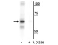Western blot of 20’ UV treated HeLa lysate showing specific immunolabeling of the ~65 kDa NF-κB p65 phosphorylated at Ser316 in the first lane (-). Phosphospecificity is shown in the second lane (+) where immunolabeling is eliminated by blot treatment with lambda phosphatase (lambda-Ptase, 1200 units for 30 min).