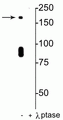 Western blot of rat hippocampal lysate showing specific immunolabeling of the ~180 kDa NR2B subunit of the NMDAR phosphorylated at in the first lane (-). Phosphospecificity is shown in the second lane (+) where immunolabeling is completely eliminated by blot treatment with lambda phosphatase (λ-Ptase, 1200 units for 30 min).