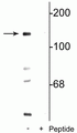 Western blot of mouse brain lysate showing specific immunolabeling of the ~140 kDa NR2C subunit of the NMDA receptor phosphorylated at Ser1096 in the first lane (-). Phosphospecificity is shown in the second lane (+) where immunolabeling is blocked by preadsorption of the phosphopeptide used as the antigen, but not by the corresponding non-phosphopeptide (not shown).