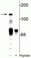 Western blot of rat cerebellar lysate showing specific immunolabeling of the ~140 kDa NR2C subunit of the NMDA receptor phosphorylated at Ser1244 in the first lane (-). Phosphospecificity is shown in the second lane (+) where immunolabeling is blocked by preadsorption of the phosphopeptide used as the antigen, but not by the corresponding non-phosphopeptide (not shown).
