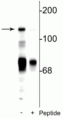 Western blot of rat cerebellar lysate showing specific immunolabeling of the ~140 kDa NR2C subunit of the NMDA receptor phosphorylated at Ser1244 in the first lane (-). Phosphospecificity is shown in the second lane (+) where immunolabeling is blocked by preadsorption of the phosphopeptide used as the antigen, but not by the corresponding non-phosphopeptide (not shown).