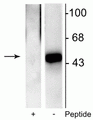 Western blot of recombinant Elk-1 showing specific immunolabeling of the ~46 kDa Elk-1 phosphorylated at Ser383 in the right lane (-). Phosphospecificity is shown in the left lane (+) where immunolabeling is blocked by preadsorption of the phosphopeptide used as the antigen, but not by the corresponding non-phosphopeptide (not shown).