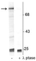 Western blot of UV treated human Jurkat cell lysate showing specific immunolabeling of the ~74 kDa Raf-1 protein phosphorylated at Ser301 in the first lane (-). Phosphospecificity is shown in the second lane (+) where the immunolabeling is completely eliminated by blot treatment with lambda phosphatase (λ-Ptase, 1200 units for 30 minutes).