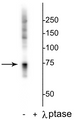 Western blot of HeLa lysate showing specific labeling of the ~74 kDa Raf 1 protein phosphorylated at Ser642 in the first lane (-). Phosphospecificity is shown in the second lane (+) where the immunolabeling is completely eliminated by blot treatment with lambda phosphatase (λ-Ptase, 1200 units for 30 minutes).