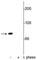 Western blot of rat cortical lysate showing specific immunolabeling of the ~78 kDa synapsin I phosphorylated at Ser549 in the first lane (-). Phosphospecificity is shown in the second lane (+) where the immunolabeling is completely eliminated by blot treatment with lambda phosphatase (λ-Ptase, 1200 units for 30 minutes).
