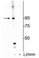 Western blot of HeLa cell lysate showing specific labeling of the ~95 kDa IR protein phosphorylated at Thr1160 in the first lane (-). Phosphospecificity is shown in the second lane (+) where immunolabeling is completely eliminated by blot treatment with lambda phosphatase (λ-Ptase, 1200 units for 30 min).