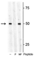 Western blot of Arabidopsis lysate showing specific immunolabeling of the ~53 kDa S6K1 phosphorylated at Thr449 in the first lane (-). Phosphospecificity is shown in the second lane (P) where immunolabeling is blocked by preadsorption with the phosphopeptide used as antigen, but not by the corresponding non-phosphopeptide in the third lane (NP).