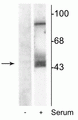 Western Blot of NIH 3T3 cell lysates showing specific immunolabeling of the ~45 kDa MEK 1/2 protein phosphorylated at Ser218 and Ser222. The cells were either serum starved (-) or incubated in the presence of serum (+). Immunolabeling of an additional band at ~95 kDa was also observed.