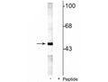 Western blot of rat testes lysate showing specific labeling of the ~49 kDa MEK5 protein phosphorylated at Ser311 Thr315 in the first lane (-). Phosphospecificity is shown in the second lane (+) where immunolabeling is blocked by preadsorption of the phosphopeptide used as the antigen, but not by the corresponding non-phosphopeptide (not shown).