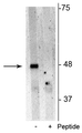 Western blot of Jurkat cell lysate showing specific immunolabeling of the ~48 kDa p62 phosphorylated at Ser28 in the first lane (-). Phosphospecificity is shown in the second lane (+) where immunolabeling is blocked by preadsorption of the phosphopeptide used as antigen, but not by the corresponding non-phosphopeptide (not shown).