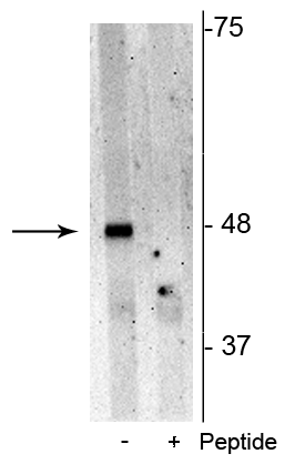 Western blot of Jurkat cell lysate showing specific immunolabeling of the ~48 kDa p62 phosphorylated at Ser28 in the first lane (-). Phosphospecificity is shown in the second lane (+) where immunolabeling is blocked by preadsorption of the phosphopeptide used as antigen, but not by the corresponding non-phosphopeptide (not shown).