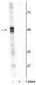 Western blot of Drosophila lysate showing specific immunolabeling of the ~60 kDa PRAS40 protein phosphorylated at Thr356 in the first lane (-). Phosphospecificity is shown in the second lane (+) where the immunolabeling is completely eliminated by blot treatment with lambda phosphatase (λ-Ptase, 1200 units for 30 minutes).