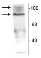 Western blot of T47D cell lysate prepared from cells that had been incubated in the presence of the synthetic progestin agonist R5020 (500 nM) showing specific immunolabeling of the ~90 kDa PR-A isoform and the ~120 kDa PR-B isoform of the progesterone receptor phosphorylated at Ser190. The immunolabeling is specifically blocked by the phosphopeptide used as the antigen (not shown).