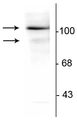Western blot of T47D cell lysate prepared from cells that had been incubated in the presence of the synthetic progestin agonist R5020 (500 nM) showing specific immunolabeling of the ~90 kDa PR-A isoform and the ~120 kDa PR-B isoform of the progesterone receptor phosphorylated at Ser294. The immunolabeling is blocked by the phosphopeptide used as the antigen (not shown).