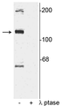 Western blot of rat cortical lysate showing specific immunolabeling of the ~120 kDa TAO2 phosphorylated at Ser181 in the first lane (-). Phosphospecificity is shown in the second lane (+) where the immunolabeling is completely eliminated by blot treatment with lambda phosphatase (λ-Ptase, 1200 units for 30 minutes).