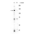 Western blot of mouse whole brain lysate showing specific labeling of the ~130 kDa IRE1 protein phosphorylated at Ser724 in the first lane (-). Phosphospecificity is shown in the second lane (+) where the immunolabeling is eliminated by blot treatment with lambda phosphatase (1200 units for 30 minutes).