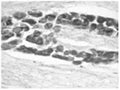Immunohistochemical staining for BDNF in rat dorsal root ganglion (DRG) using Rabbit antibody to rh BDNF: IgG (R-017-500) at an amount of 5 µg/mL. Neuron cell bodies are strongly stained for BDNF.