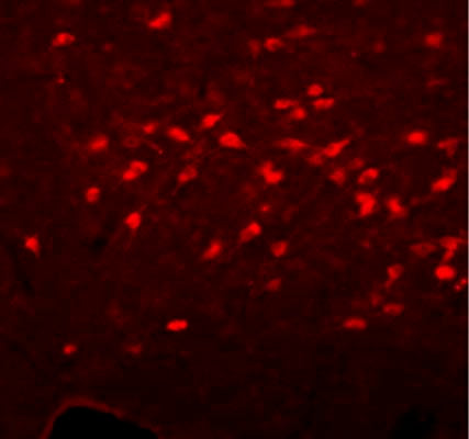 Immunofluorescent staining of rat basal forebrain cholinergic neurons using rabbit anti-ChAT primary and Cy3 secondary antibodies.