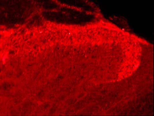 Immunohistochemical staining of rat spinal cord using rabbit antibody to human capsaicin receptor, catalog number R-053-100.