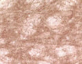 Immunohistochemical staining of gamma synuclein in rat brainstem using rabbit polyclonal to human gamma synuclein, catalogue number R-058-100.