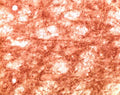 Immunohistochemical staining of gamma synuclein in rat brain tissue using rabbit polyclonal to human gamma synuclein, catalogue number R-058-100.