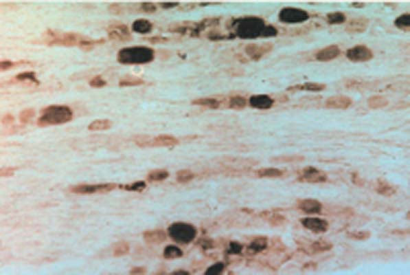 Immunohistochemical staining of rat dorsal root ganglia using Rabbit antibody to to GFR alpha-2 (376-390): whole serum, catalogue no. R-067-100.