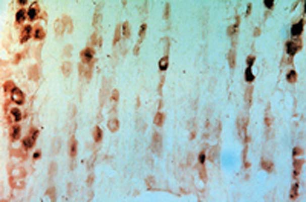 Immunohistochemical staining of rat dorsal root ganglia using Rabbit antibody to to GFR alpha-3 (1-11): whole serum, catalogue no. R-068-100.