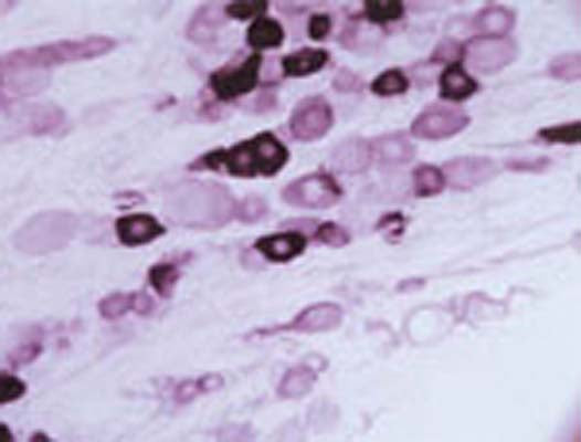 Immunohistochemical staining of Vanilloid Receptor Like Protein (VRL-1) in rat trigeminal ganglion using rabbit polyclonal antibody to rat VRL-1, catalogue number R-078-50.