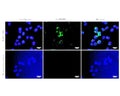 Immunofluorescence analysis of proBDNF expression in human SHSY-5Y cells. Fixed (4% formaldehyde), permeabilized, and blocked (10% normal horse serum, 0.1% Triton X100) SHSY-5Y cells were incubated with proBDNF antibody R-087-100 (1:1000, green) for 1 hour. Primary antibody binding was visualized with a secondary donkey anti-rabbit-CF488A antibody (4 µg/mL, 1 hour incubation). Cell nuclei were stained with Hoechst dye (blue). BDNF-IR is observed in the perinuclear cytoplasm. Magnification: 100x.
