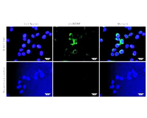 Immunofluorescence analysis of proBDNF expression in human SHSY-5Y cells. Fixed (4% formaldehyde), permeabilized, and blocked (10% normal horse serum, 0.1% Triton X100) SHSY-5Y cells were incubated with proBDNF antibody R-087-100 (1:1000, green) for 1 hour. Primary antibody binding was visualized with a secondary donkey anti-rabbit-CF488A antibody (4 µg/mL, 1 hour incubation). Cell nuclei were stained with Hoechst dye (blue). BDNF-IR is observed in the perinuclear cytoplasm. Magnification: 100x.