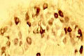 Immunohistochemical staining for BDNF in rat dorsal root ganglion (DRG) using Rabbit anti-rh BDNF antibody R-088-100 at 1:1000 dilution. Neuron cell bodies are strongly stained for BDNF.